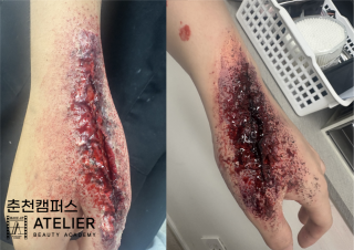 구더기 및 상처분장